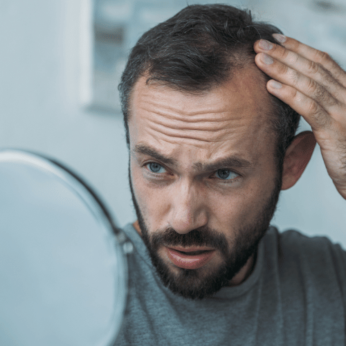 hair loss in men