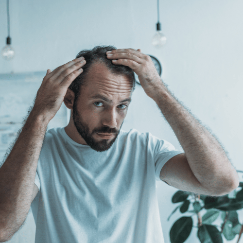 men hair loss